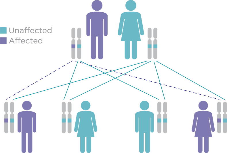 cystic fibrosis